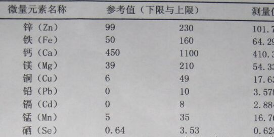 微量元素检测仪厂家简述微量元素及检查