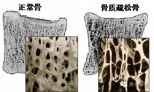 这么多小穴什么情况?不急来一个台骨密度仪检测检测