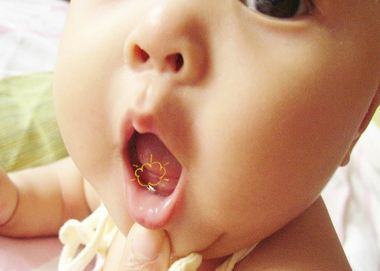 儿童骨密度仪告诉你宝宝出牙晚不一定是缺钙