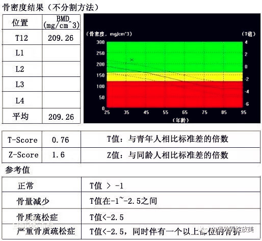 骨密度仪检测设备检测骨密度正常值偏低保卫骨密