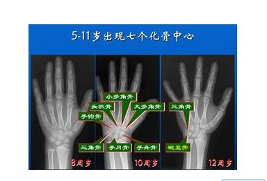 骨密度仪最好品牌的仪器能够预测骨骼发育情况判断孩子未来身高 骨密度仪最好品牌的仪器能够预测骨骼发育情况判断孩子未来身高