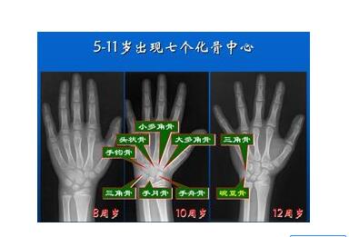 骨密度仪最好品牌的仪器能够预测骨骼发育情况判断孩子未来身高