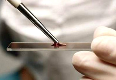 微量元素分析仪品牌介绍血液微量元素检测主要检查什么？